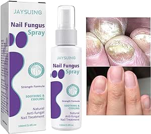 Antifungal Nail Treatment Spray