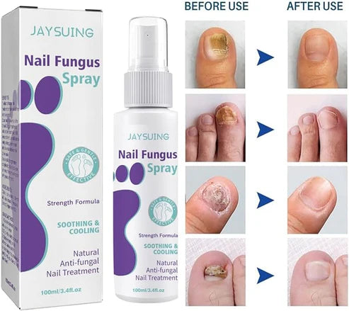Antifungal Nail Treatment Spray